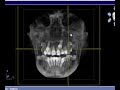 3D View of CBCT