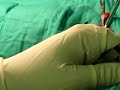 Flank Spay