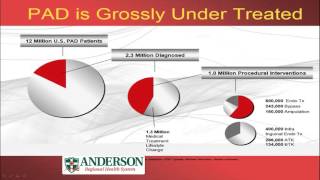 Peripheral artery disease