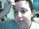 Lupus or a Spider bite?? WTF?! Lupus or a Spider bite?? WTF?!