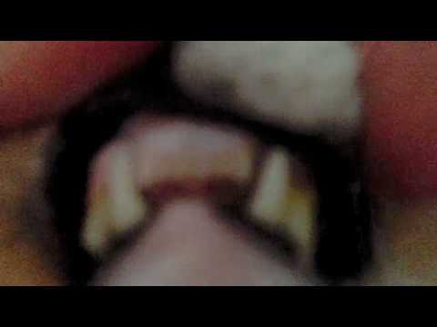 CAT TEETH