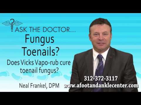 how to kill toenail fungus vicks vapor rub