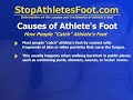 Causes Of Athlete's Foot Tinea Infections