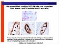 Stem Cells Reversing Endothelial Senescence