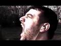 299: The Adventures of King Tendonitis - This is Sparta,NY