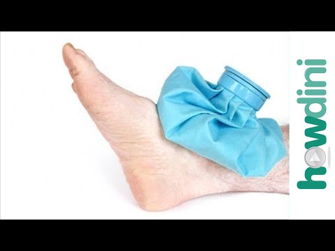 how to relieve sprained foot