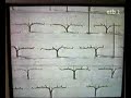 Aralar y Navarra 070322