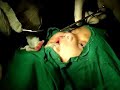 Fakhr Alkhairy - Surgeon\ Fakhr Alkhairy - Surgeon\