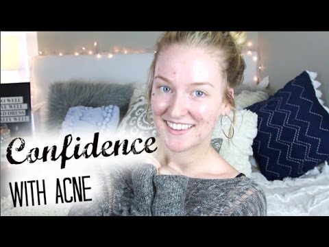 how to be confident with acne