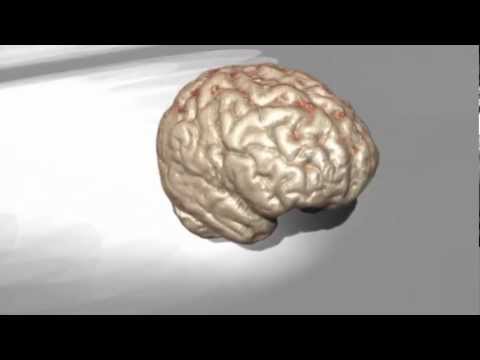 how to isolate mouse hypothalamus