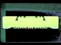 John F Kennedy Assasination Zapruder Film with Bullet 1978