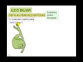 ABDOMEN AGUDO OBSTRUCTIVO 3