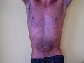 man hairy abs