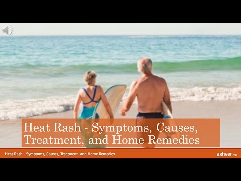how to cure heat rash