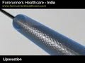 Low cost liposculpture at cosmetic clinics in India Lipoplasty