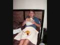 James' Umbilical Hernia Surgery