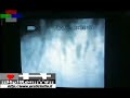 HULKEN VIDEO MUSICALE + \
