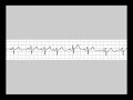 CORSO MULTIMEDIALE DI ECG