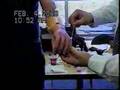 Myoelektric-arm