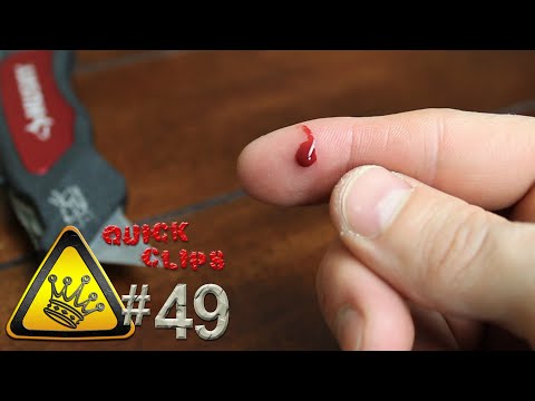 how to treat knife cut on finger