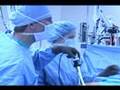 Arthroscopic Knee Surgery