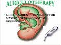 Super Brain - Part 6 of 8 Auriculotherapy