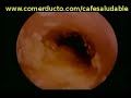 Investigacion sobre ganoderma