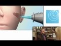 Lantos Technologies - 3D Ear Canal Scanning System