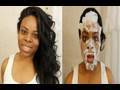 How To Remove Blackheads: Skin Care