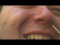 nose hair pick 3