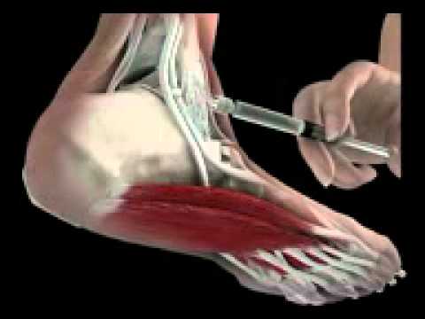 how to treat sgot