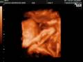 Gavin Brody Hammond - 3D Ultrasound - 30 Weeks - 1-10-2009
