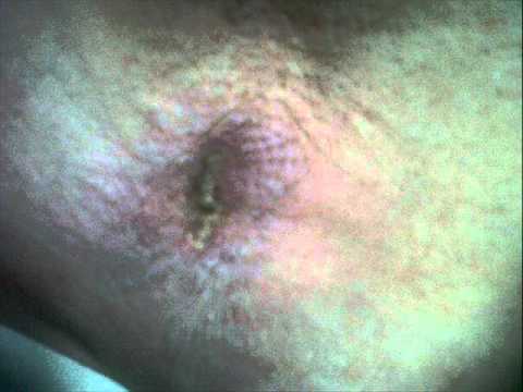 how to unclog lymph nodes in armpit