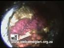 Anatomy of a flea - microscopic view