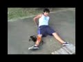 Fractura