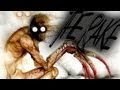 The Rake
