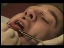 Tongue tied