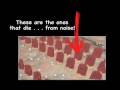 hearing loss loud treatment