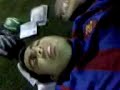 Fractura de Tobillo
