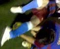 Fractura de Tobillo