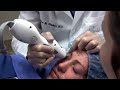 Thermage NYC Treatment by NY Cosmetic Dermatologist