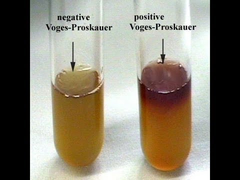 how to do mr vp test