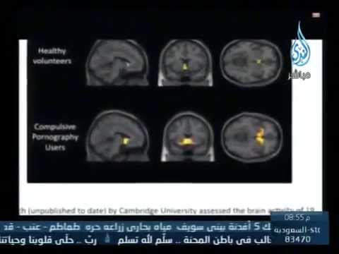 شاهد خطورة مشاهدة الأفلام الإباحية على جسم الإنسان