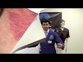 In this video we describe miliaria, also known commonly as heat rash or sweat rash.