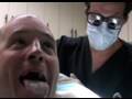Hair-Transplants-Fun