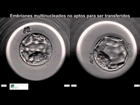 Ver video