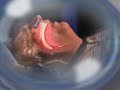 What is sleep apnea