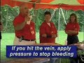 What can you do to stop the bleeding if you hit the vein while tattooing?