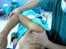 Load and shift test preop examination shoulder dislocation