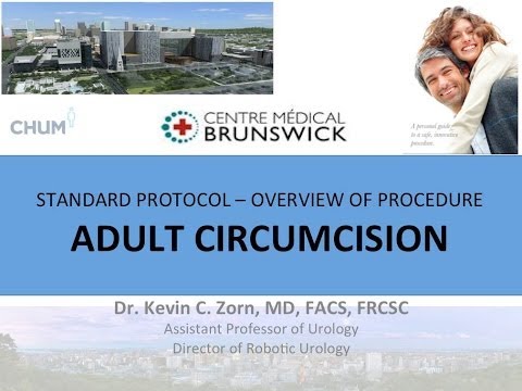 adult circumcision - Male circumcision is performed on an estimated one out of six male newborns worldwide. Over 60 percent of male newborns were circumcised in the United States...